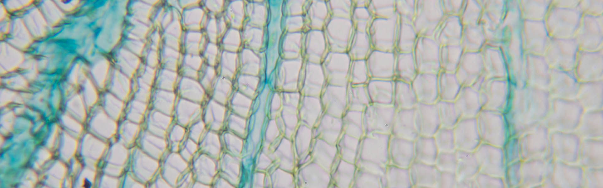 Microscopic cells (White)